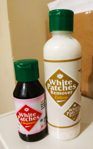 Bbright Beauty White Patches Remover lotion(250ml)+white patches Cleanser 2 in 1